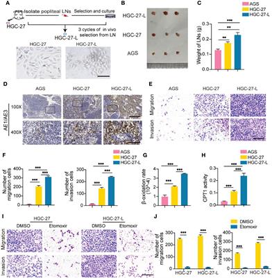 Exosomal CD44 Transmits Lymph Node Metastatic Capacity Between Gastric Cancer Cells via YAP-CPT1A-Mediated FAO Reprogramming